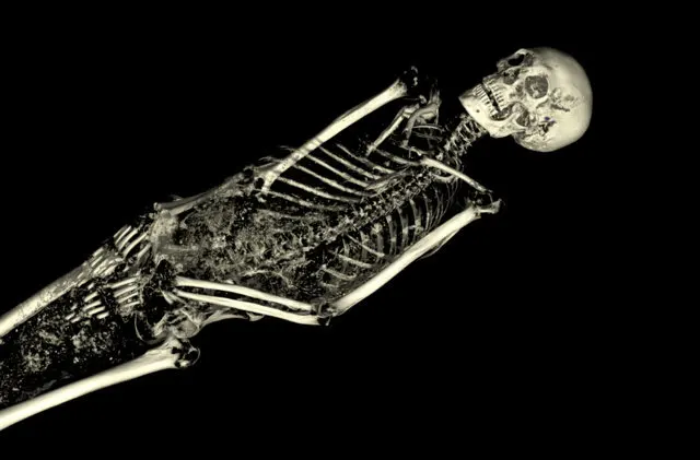 A black and white image of a skeleton.